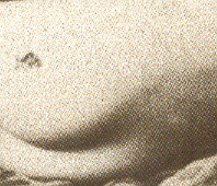 Tentklein (52k image)